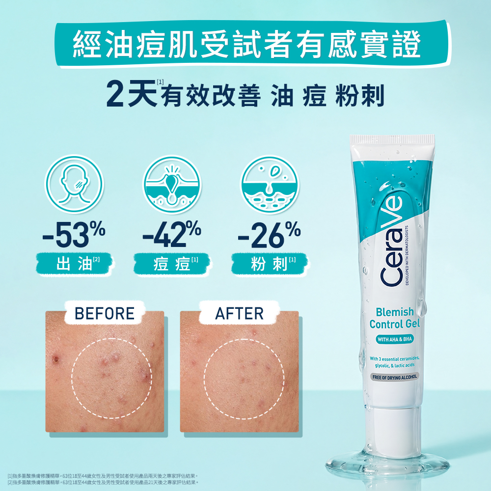 經油痘肌受試者有感實證，2天有效改善油痘粉刺